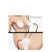 Temptasia - Beginners Clitorial Pump System Temptasia - Beginners Clitorial Pump System